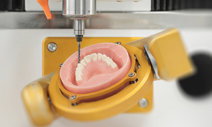 CAD-CAM
